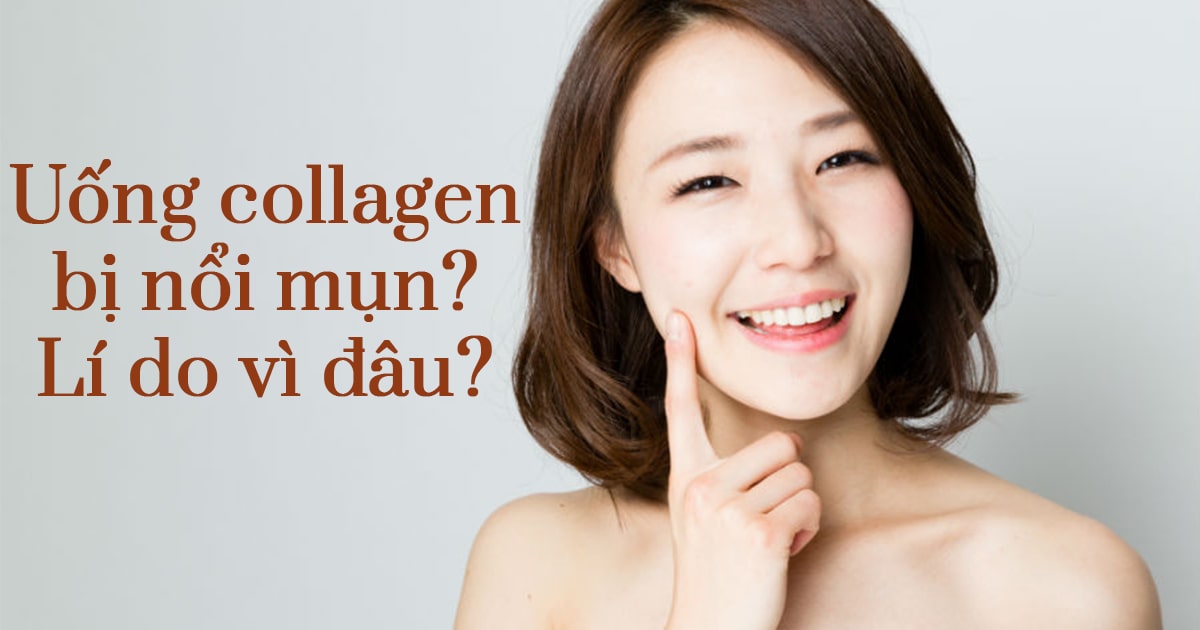 Uống Collagen DHC nước có bị nổi mụn không?